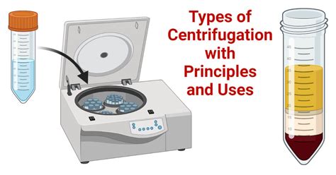 separating centrifuge|centrifugation principle and types.